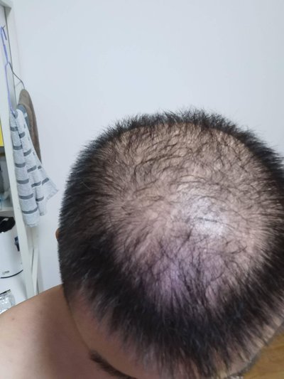 重庆卫健委最新数据：治